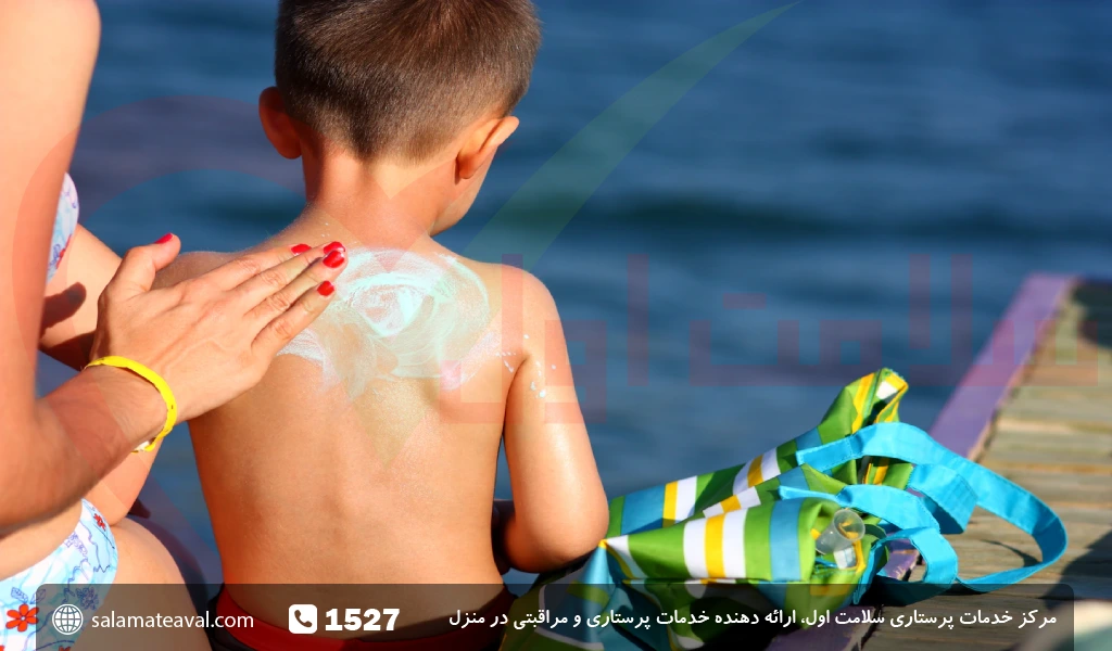 درمان آفتاب سوختگی پوست کودکان