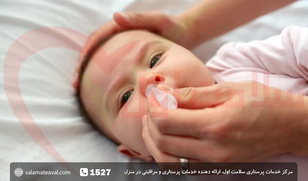 درمان سریع کیپ شدن بینی نوزاد