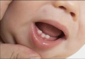 دندان در آوردن کودک و رشد آن