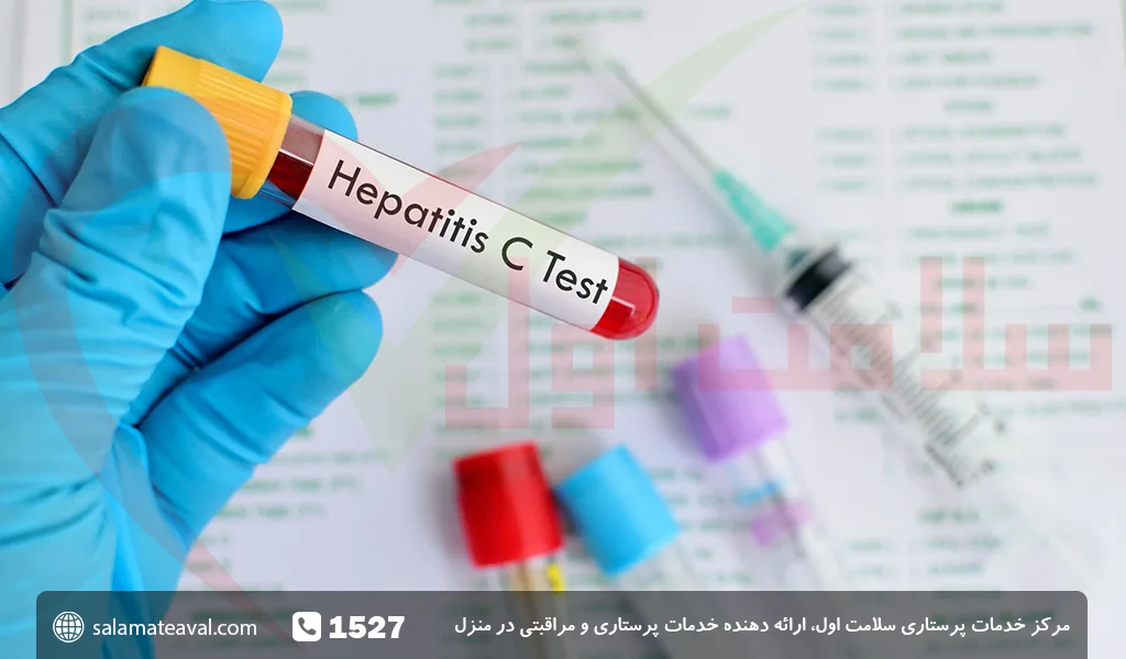 C Hepatitis چیست
