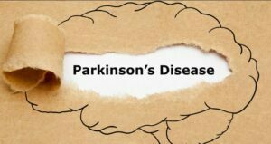 علایم بیماری پارکینسون