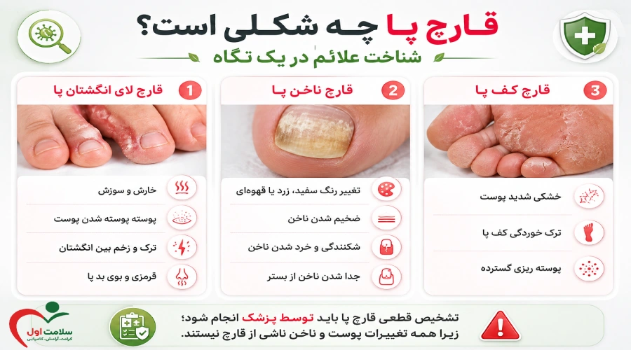 قارچ پا چه شکلی است؟