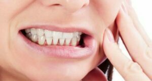 پیشگیری از دندان قروچه
