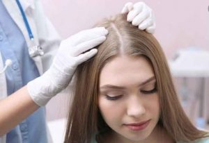 روش درمان ریزش مو در زنان