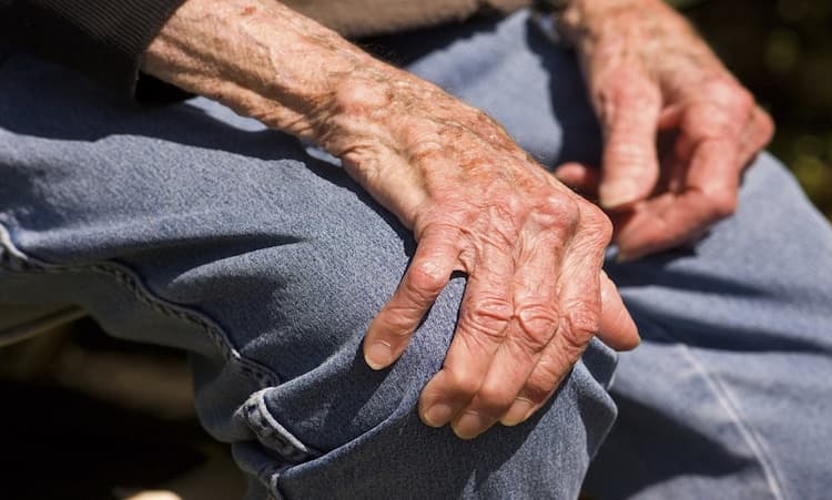 دلایل بیماری آرتروز در سالمندان