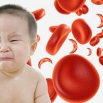 کم خونی در کودکان؛-وب سایت سلامت اول