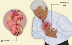 عارضه‌های رایج قلبی سالمندان