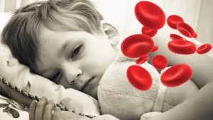 علت های کم خونی در کودکان چیست؟