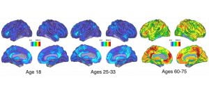 عملکرد مغز با افزایش سن چگونه است؟