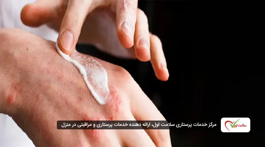 بیماریهای خودایمنی طیف گستردهای از اختلالات را شامل میشوند که هرکدام ممکن است یک اندام یا چندین سیستم بدن را درگیر کنند.