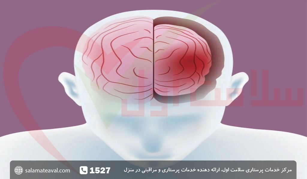 روش های درمان کوچک شدن مغز و آتروفی مغزی