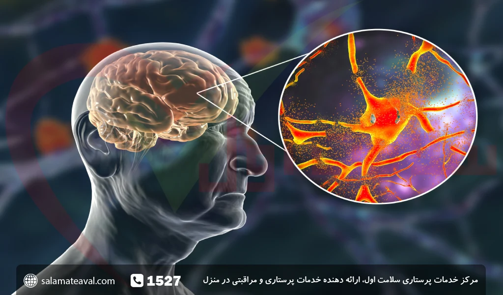 آتروفی یا کوچک شدن مغز چیست؟