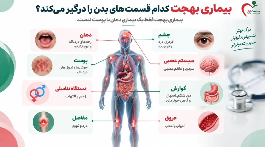 بیماری بهجت کدام قسمت های بدن را درگیر می کند؟