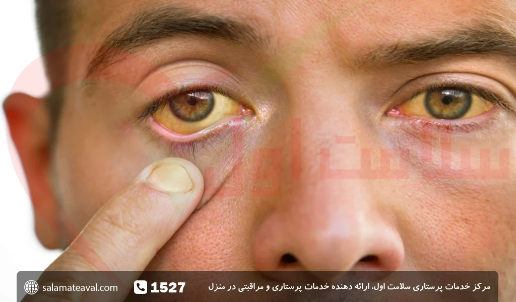 درمان تخریب لکه زرد چشم در سالمندان