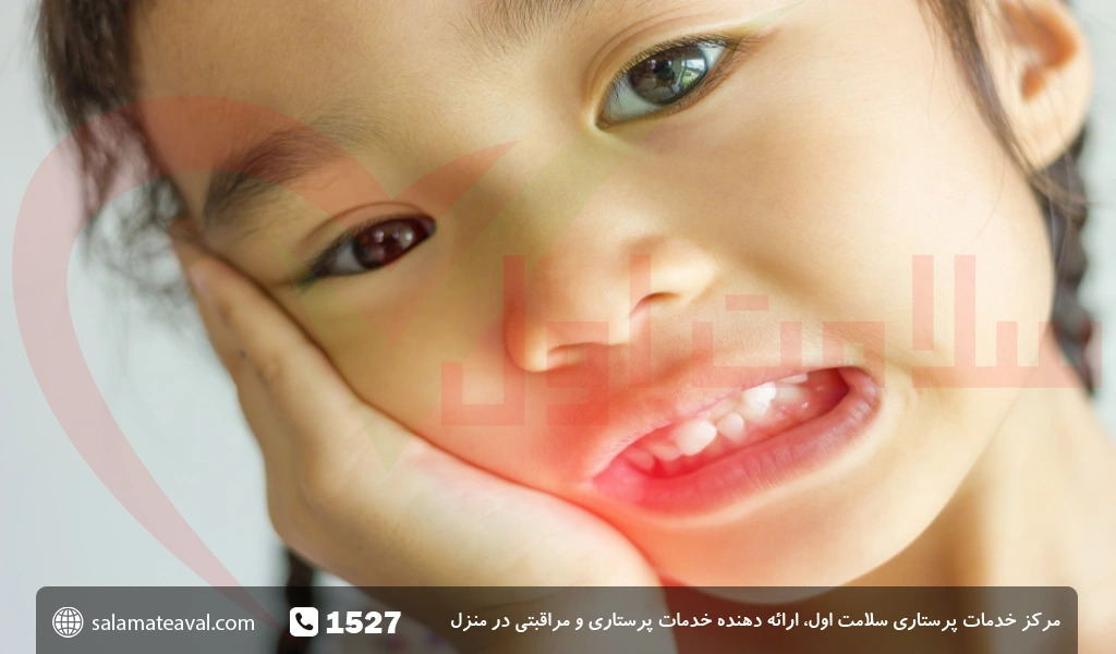 عکس آبسه دندان و لثه کودک 