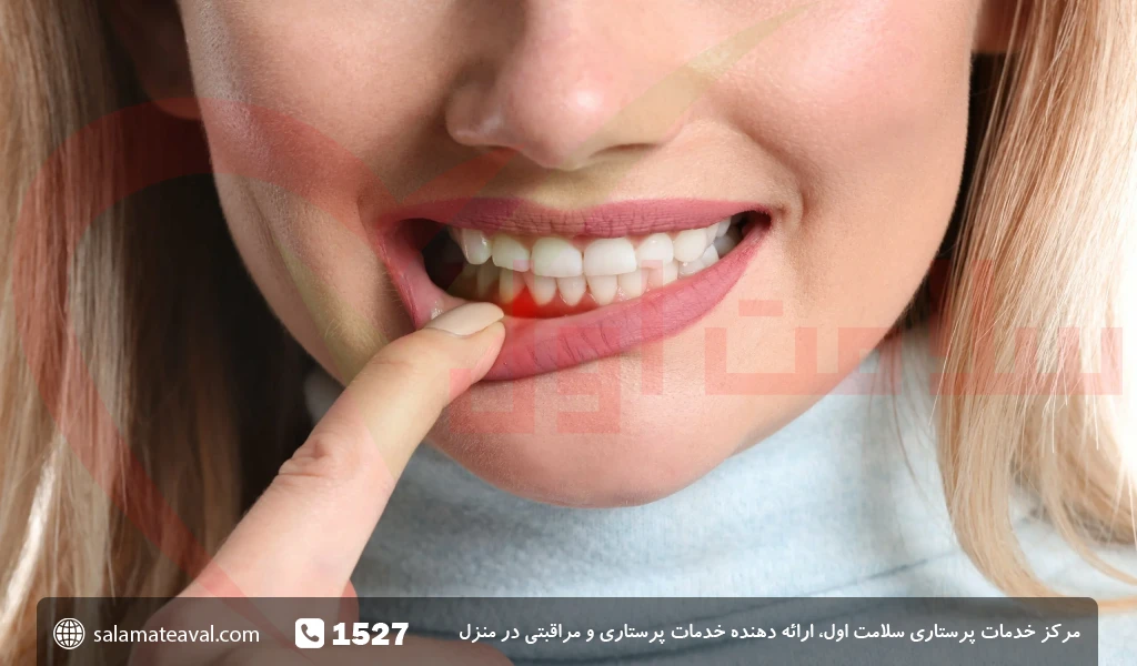 عوارض درمان نکردن آبسه دندان