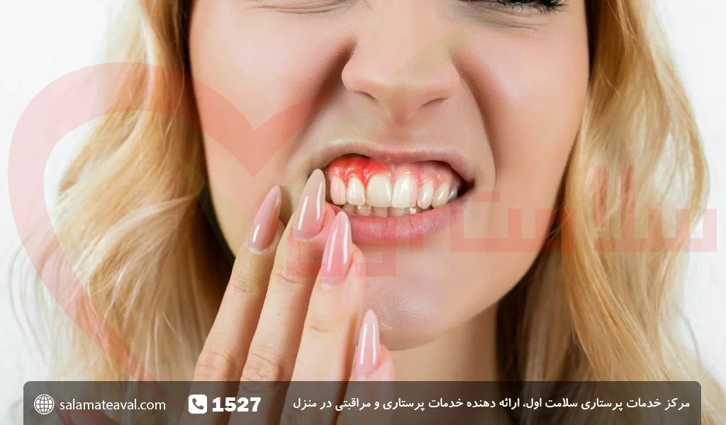 آبسه دندان؛ روش درمان آبسه دندان و لثه
