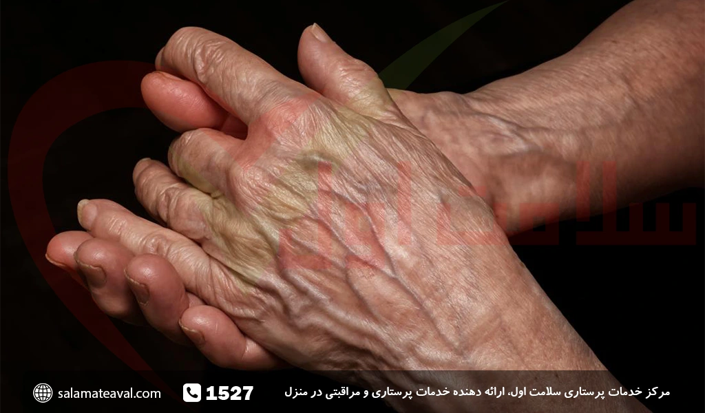 علت خشک شدن پوست سالمندان