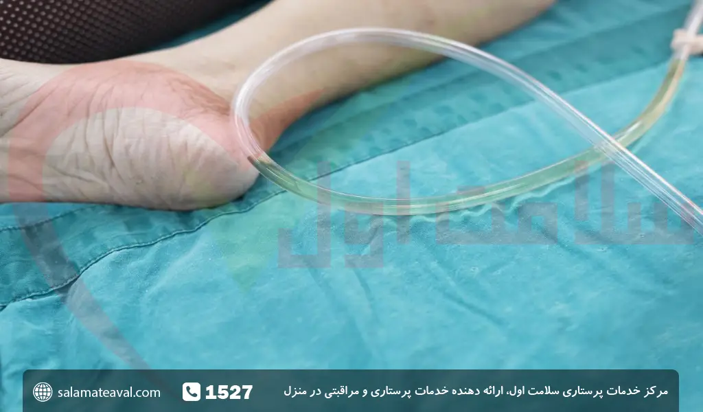 مزایای انجام سونداژ در منزل توسط پرستار متخصص