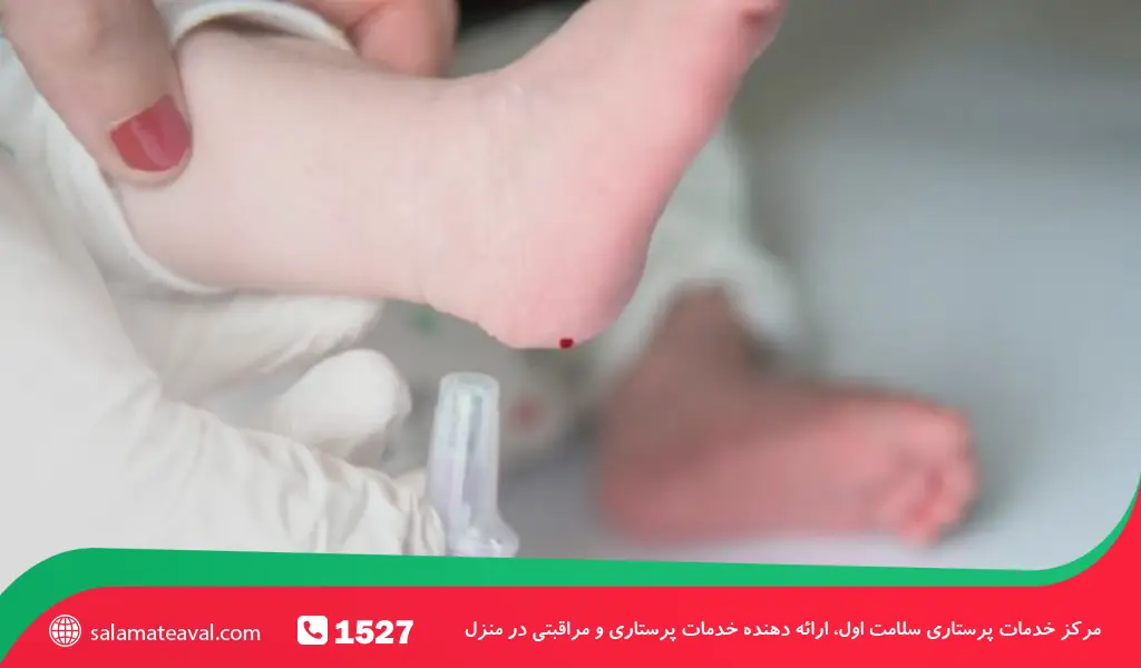 تست زردی با آزمایش خون