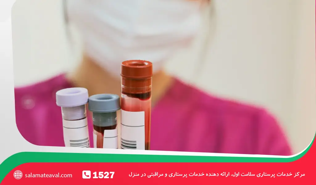 آزمایش چربی خون