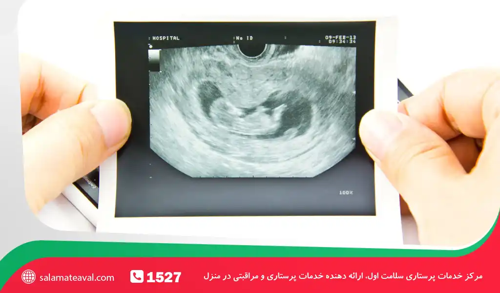 دلایل غیرمستقیم سقط جنین