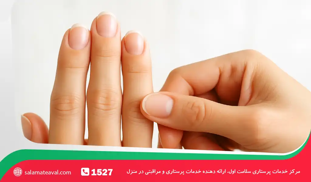 چه زمانی باید برای کبودی زیر ناخن به پزشک مراجعه کرد؟