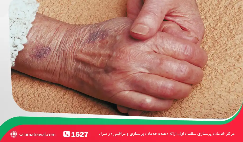 آموزش، نظارت و نقش پرستار سالمند در منزل