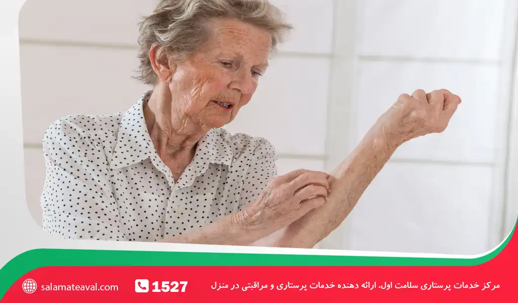 تشخیص افتراقی و بررسیهای تشخیصی کبودی ناگهانی سالمندان