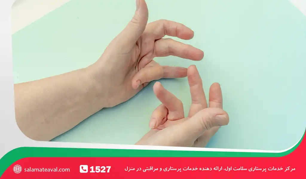 علائم کلسترول بالا در انگشتان حلقه و کوچک و ارتباط آن با انقباض دوپویترن