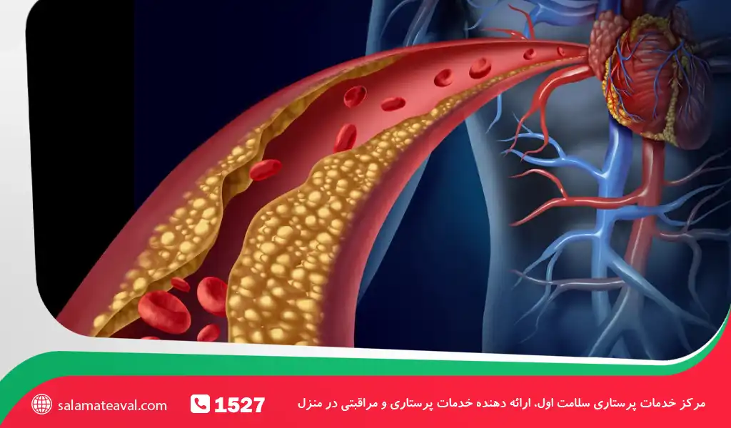 درک کلسترول در بدن و اهمیت آن