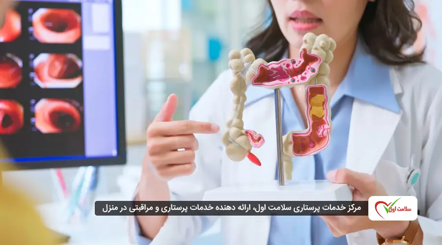 عمل جراحی سرطان روده|مراقبت‌های بعد از جراحی روده بزرگ