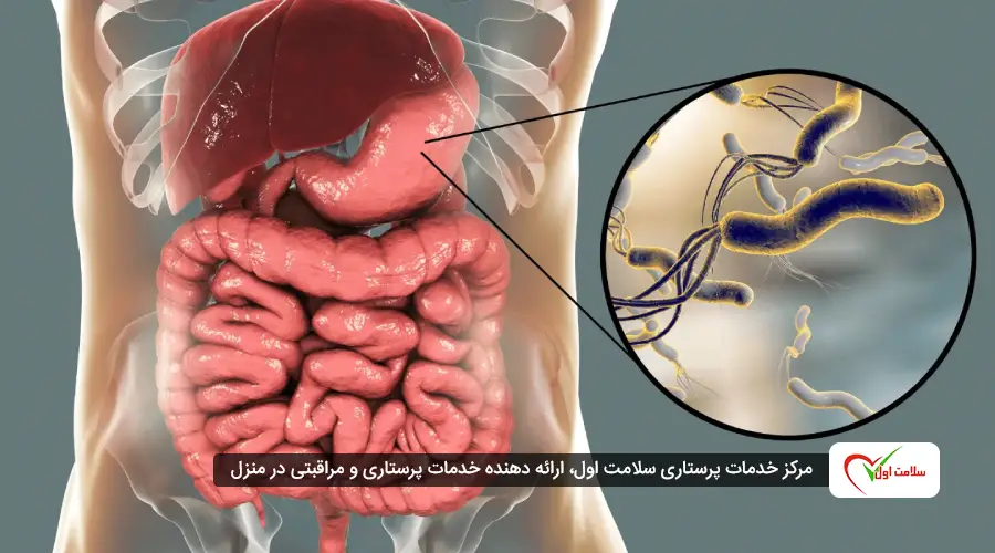 میکروب معده چگونه عمل می‌کند؟