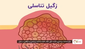 زگیل تناسلی زنان