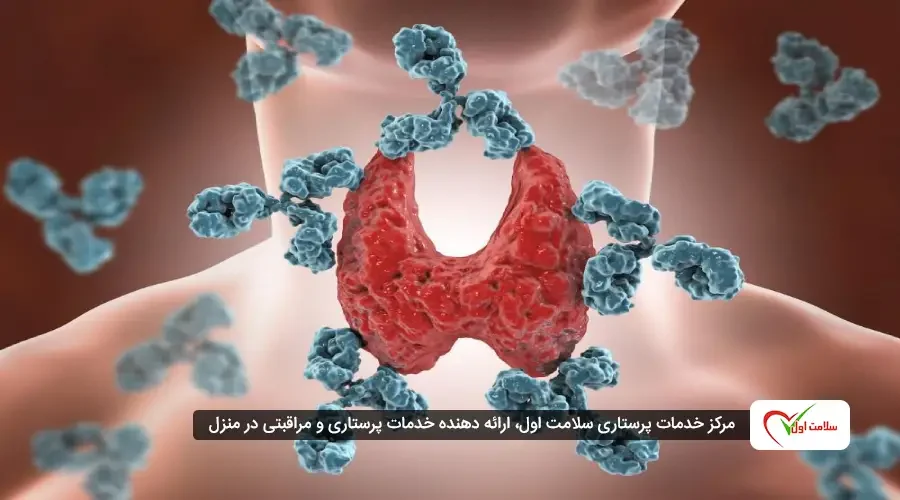 بیماری‌ های خودایمنی: علائم، تشخیص، درمان و مراقبت