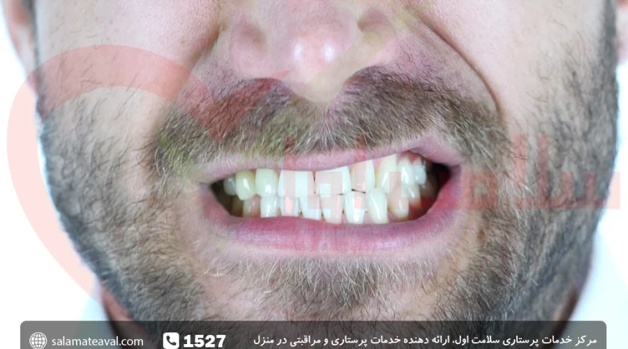 دندان قروچه چیست؛ علائم، درمان و پیشگیری از آن