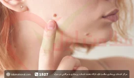 زگیل چیست؛ نحوه انتقال و درمان زگیل