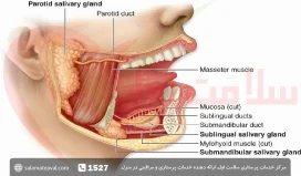 عکس سنگ غدد بزاقی؛ علائم و درمان سنگ بزاقی