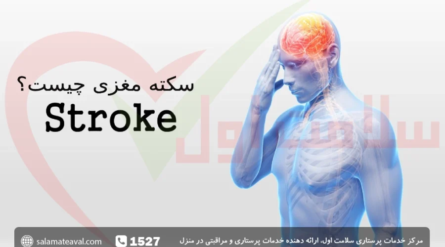 سکته مغزی؛ علائم سکته مغزی در زنان و مردان